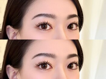 エイシェル/フラットラッシュ140本