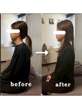 マクシル 札幌店 puls1(MAXIL)/足のむくみと肩こり