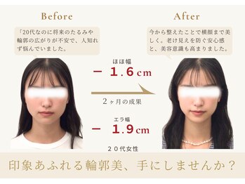 アロハ(ALOHA.)/印象を変える輪郭、手にしない?