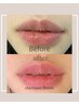 メラニンケア《唇・Lip》¥58000→¥45000