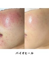 フロムミー 銀座本店(FROM ME)/