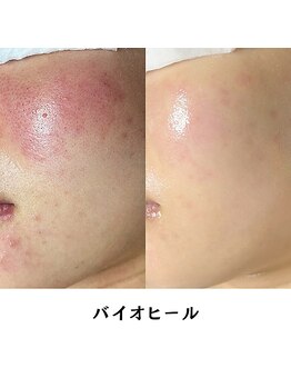 フロムミー 銀座本店(FROM ME)/