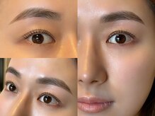 アイコニック(EYECONIQ)