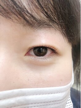 フリルアイビューティー 東中野(Frill Eye Beauty by Blossom)/一重・奥二重さんのパリジェンヌ