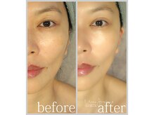 アン グレーヌ 自由が丘(unegraine)/くすみのない透明感溢れる美肌！