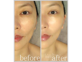 アン グレーヌ 自由が丘(unegraine)/くすみのない透明感溢れる美肌！