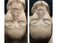 リバイセリー(Revicelly)/年齢によるお悩み解決◎