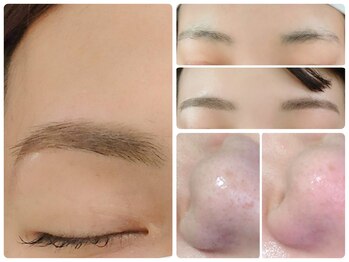 トータルビューティ ノイド(Noid)/小鼻コース+美眉毛WAX脱毛