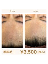 クラウドナイン(CLOUD NINE)