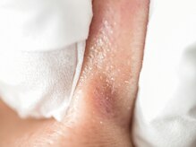 ピュアボーテ(PURE BEAUTE)の雰囲気(開いた毛穴でファンデーションがボコボコ/毛穴落ちする方へ☆)