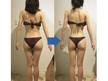 ピュアトゥルー 岐阜西店(PureTrue)/余分なお肉に高周波！ラジオ派！