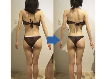 ピュアトゥルー 岐阜西店(PureTrue)/余分なお肉に高周波！ラジオ派！