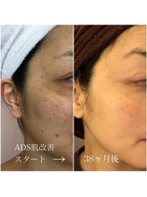 ビューティーサロン メイプルツリー/2020年リセラプリンセス受賞