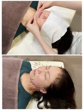 まごころ整骨院/人気No.1　美容鍼＋小顔矯正