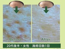 マテリア 心斎橋本店(Materia)の雰囲気（【心斎橋エステサロン】人気のハーブオフ）