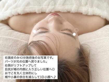 パール(Pearl)の写真