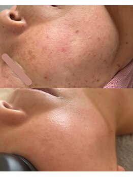 ナンバーナイン(No.9)の写真/諦めないで。くすみ印象に夏でもできるシミしわケア