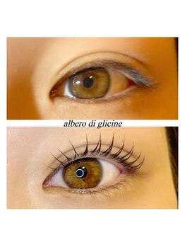 アルベロ ディ グリーチネ(albero di glicine)/マツパ☆ビフォアフ