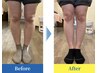 脚の歪みが気になる方へ～コンプレックスを自信に～《O脚矯正プログラム》