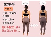 フーレ(Foule)/【30代】産後4年経過　15回目