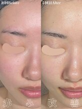 ゼアー(THERE FY.)&nbsp;肌質改善 化粧品