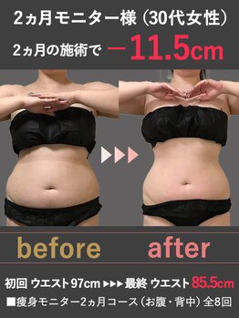 蓮子の夢/2ヵ月で-11.5cm！