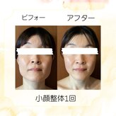 マロカ(Marroka)