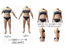 1回でも驚異の変化！継続もしやすい低価格。事前の金額提示。