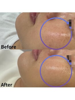 アピール(Appeal)/目の下に注目!!