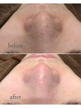 アモール 丸亀店(Amor)/眉毛/まつげパーマ/毛穴/脱毛