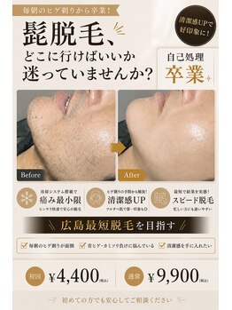 プリエ(Prier)の写真/広島で最短ヒゲ脱毛を目指すならprierで!青ヒゲ・毎朝の自己処理から卒業!
髭脱毛で美肌にも♪