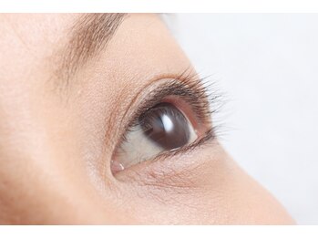 コージープレイスアイビューティー(Cozy Place eye beauty)/before