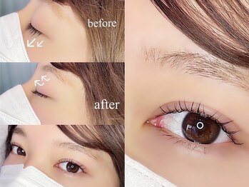 レガオスビューティー(Regaos_Beauty)/ぱっちり