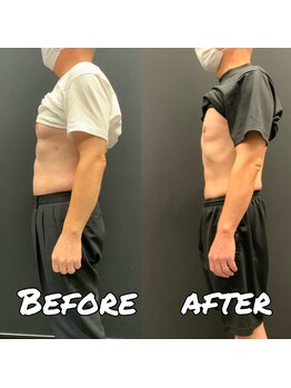 ビーライフ(BE LIFE)/50代男性3ヶ月体重11キロ減