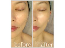 アン グレーヌ 自由が丘(unegraine)/絹のような滑らか肌に