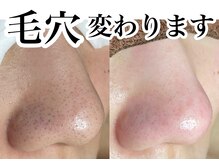 アンドピエル(AndPiel)の雰囲気（変化の分かるフェイシャル専門店で満足の仕上がり！）