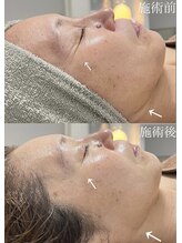 クレヴィー(Creviy)/最先端の細胞美容