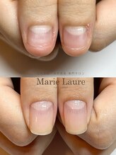 マリーロール 梅田店(Marie Laure)/自爪育成/深爪矯正/ネイルケア