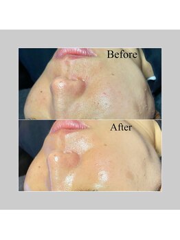 ブラックボックス(BLACK BOX)/ひたちなか市O様40代