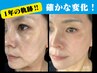【シミに終止符！】シミ・くすみを根本改善プログラム120分 　初回限定