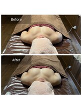 リノレア(LinoLea)/