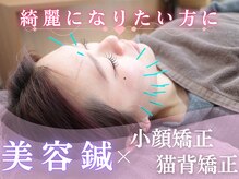 栄光治院 岡崎本院/【効果実感NO.1！】美容鍼