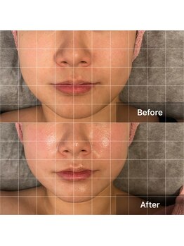 ルミナス(LUMINOUS)/小顔になりたい！