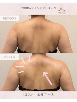 スーペリオル(Superior)/慢性的な首肩コリも根本解決!