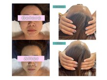 小顔＆美肌＆エイジングケアは男性にも人気★