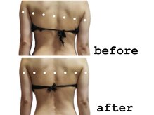 バーテックスキー(Vertexkey)の雰囲気（何をしても痩せなかった方へ）