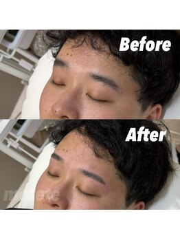 モテテ 池袋店(motete)/お客様施術例☆池袋 12