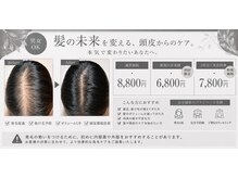 ルミア(Lumia)の雰囲気（医療提携の高圧ジェットで頭皮の奥まで幹細胞を注入し育毛を促進）