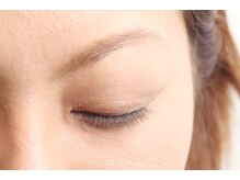 コージープレイスアイビューティー(Cozy Place eye beauty)/before