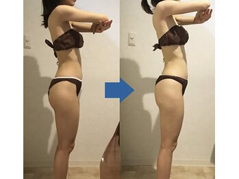 ピュアトゥルー 岐阜西店(PureTrue)/余分なお肉に高周波！ラジオ派！